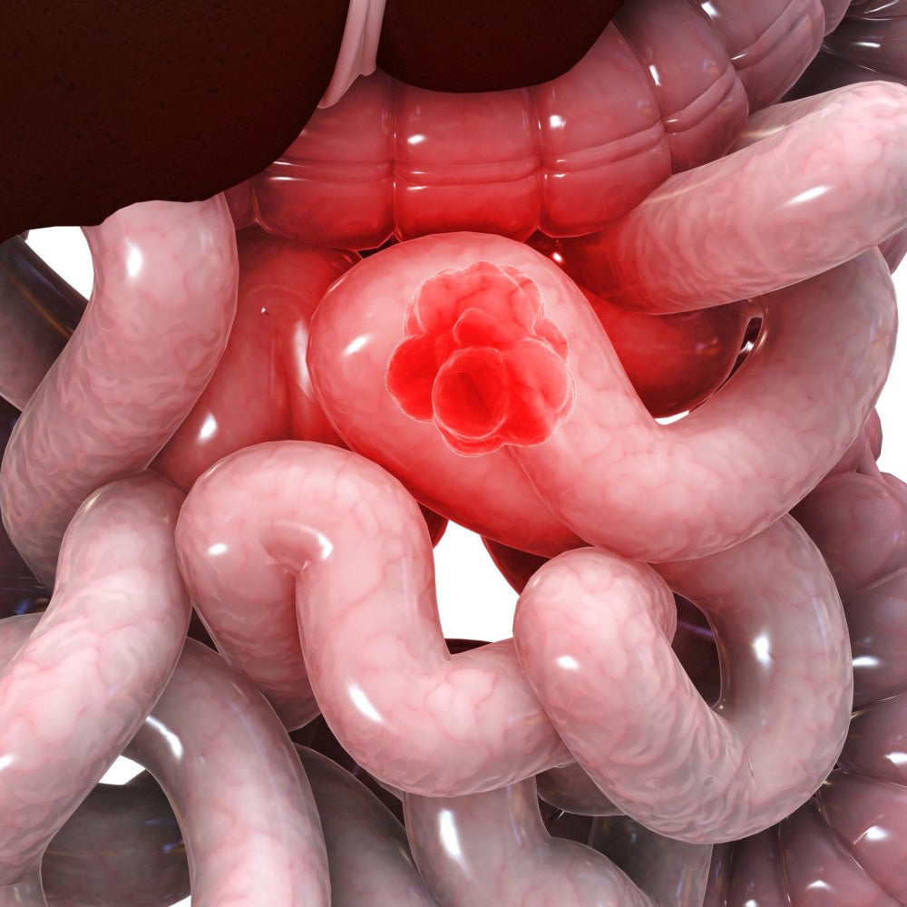 Gut Health – What It Means to Feel It in Your Gut