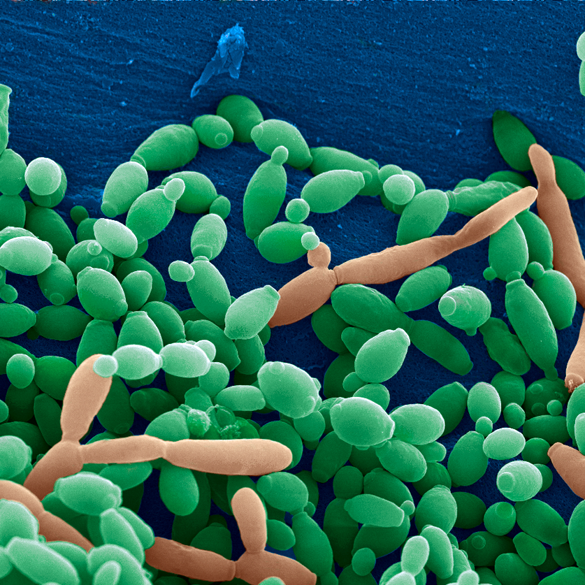 Candida Symptoms and How to Treat Them