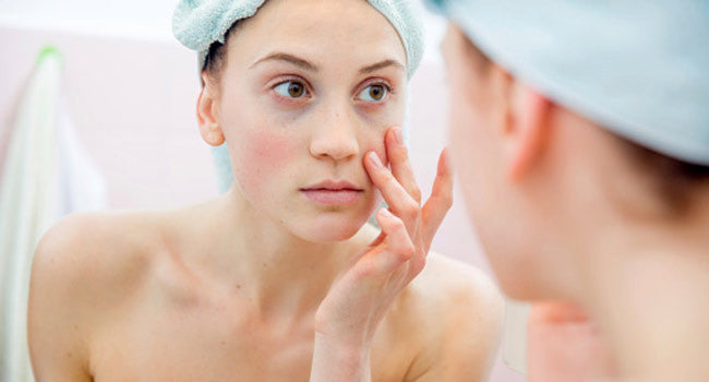 The Pimples Diet, the Easy Solution to Pimple-Free Skin